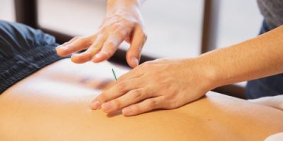 Acupuncture Dover New Hampshire